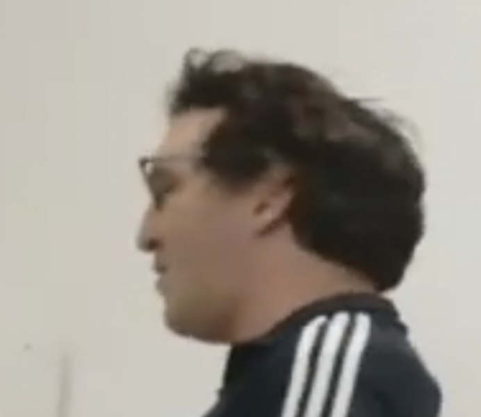 Fájl:Agyhiany.png