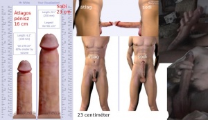 Sodipenis.jpg